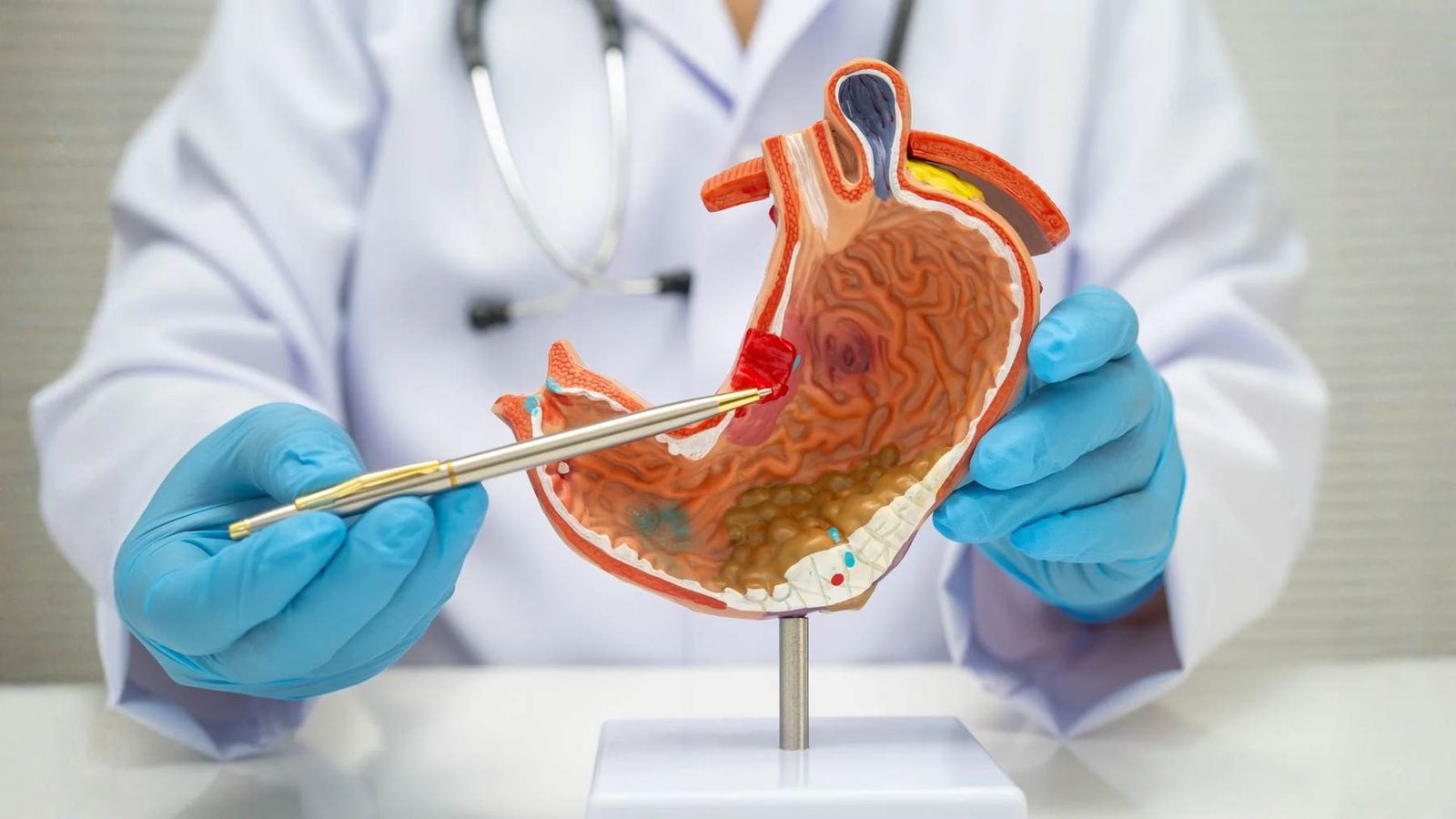 Digestive Health Care